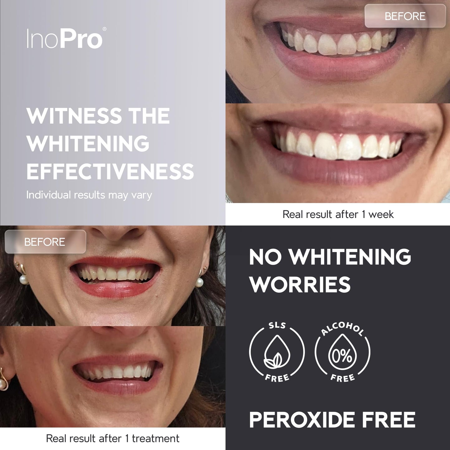 InoPro Natural Teeth Whitening Strips Kit 14 Treatments - Sensitive Teeth Whitener, Peroxide Free, Enamel Safe White Strips - Instant Teeth Whitening Without The Harm (28 Strips)