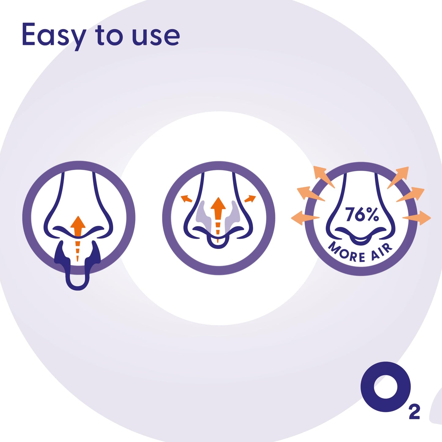 AIRMAX Nasal dilators for Sleeping - 76% More Airflow - Anti snoring Devices - Breathe Freely Through The Nose - Sinus Relief, Relief and snoring Solution - 2X Medium Orange - 6 Month Relief